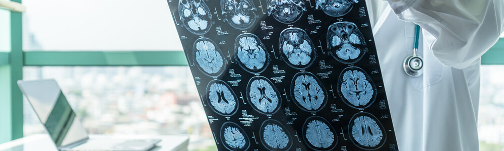 Marktkommentar zur FDA-Zulassung für das Alzheimermedikament Aduhelm.